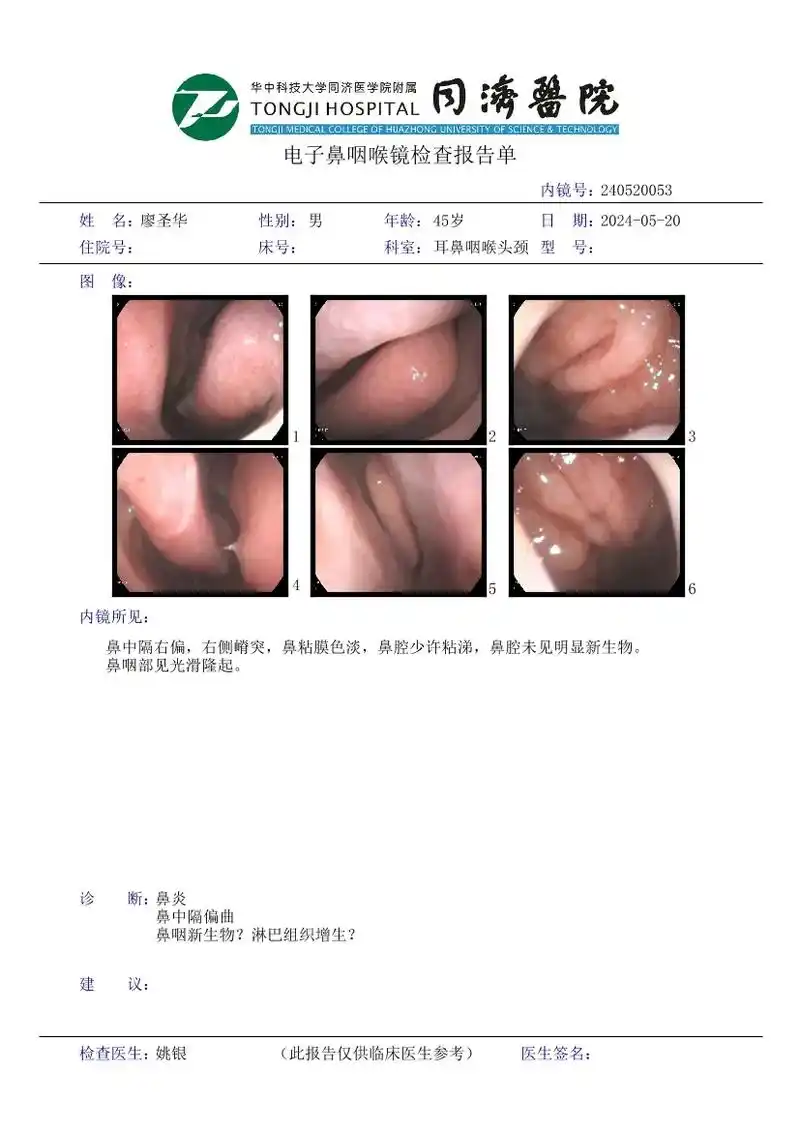从5月20日检查到今天已经整一个月了.从开始的检查到做手术活检结果