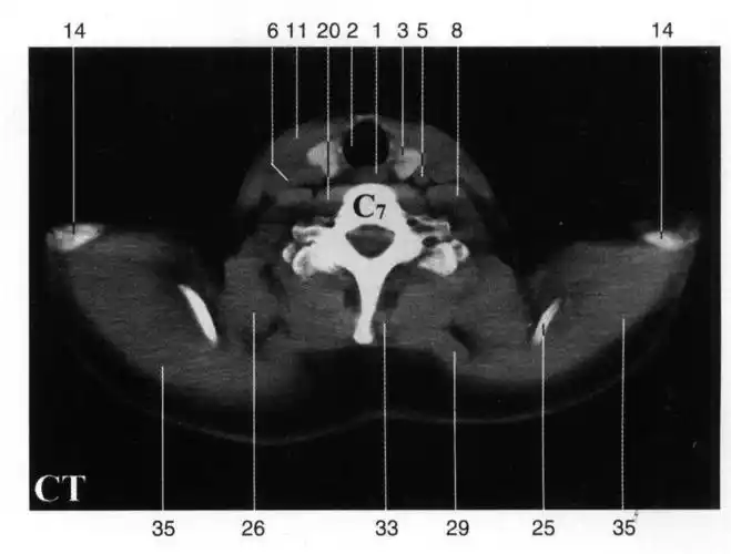 ht 1-断面解剖与mri ct ect对照-医学