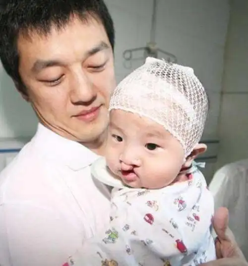 14岁李嫣脸部恢复正常穿衣越来越有品味身高都快赶上爸爸了