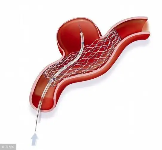 23岁大学生海绵体破裂急诊手术三小时医生说都是女友害的