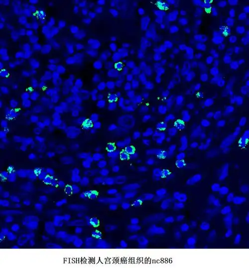 rna荧光原位杂交(rna-fish)