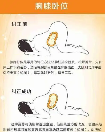 脐带绕颈的胎位不正,因为如果脐带绕颈的话千万不能用胸膝卧位法的