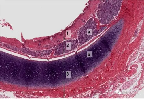 简述气管壁的光镜结构及功能