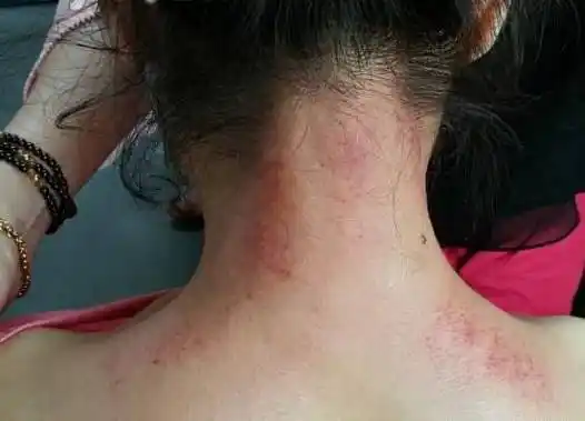 刮肩颈,防百病,人的衰老从肩颈开始!_刮痧