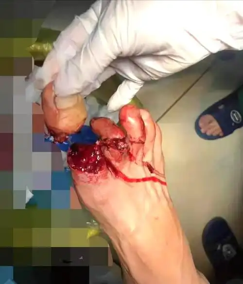 只(趾)要敢,便值得拥有