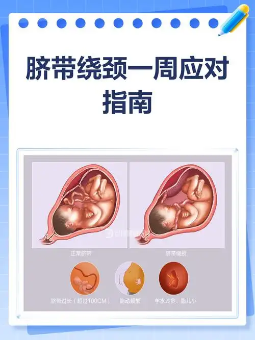 脐带绕颈一周,别慌!这样应对
