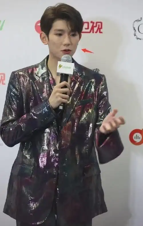 王源出席活动宣传新歌,皮肤状态再引热议,美颜都盖不住痘印