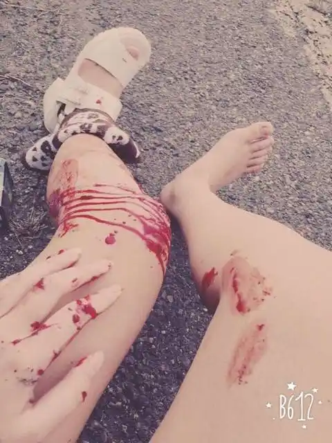 拍了几十张才选出这一张最好看的,要不是失血过多有点头晕老娘非得拍