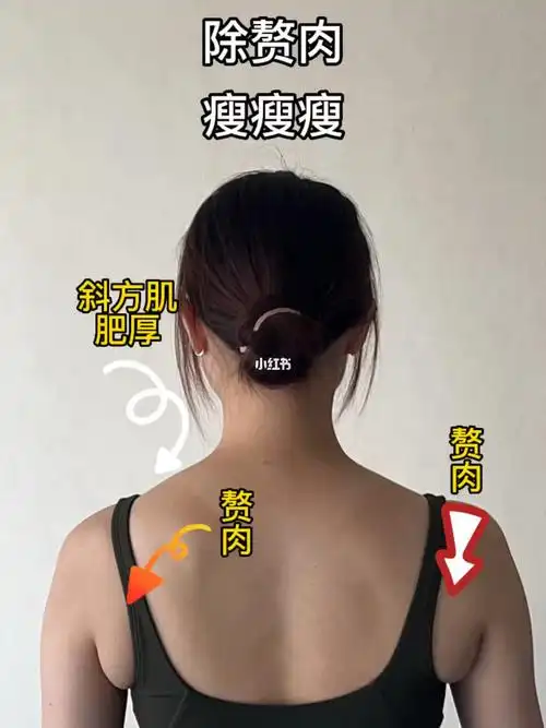 斜方肌肥厚赘肉3步消除法