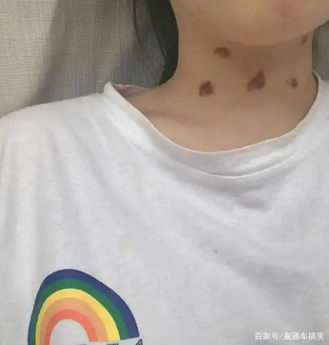 出差回来发现老婆脖子上好多草莓,她说自己挠的,我是不是被绿了