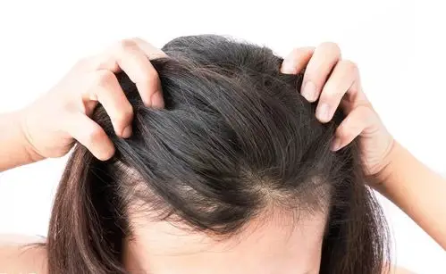 偏爱辛辣,夜宵不能停,头皮敏感长痘,发痒难耐.