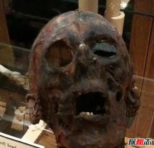 美国穆特博物馆肥皂女尸重口味分分钟想吐腐烂女尸成肥皂