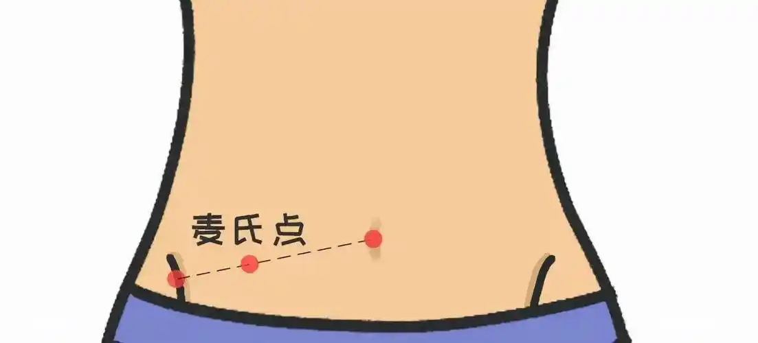 首先,检测阑尾炎最根本的就是要刺激到阑尾所在的地方,又称麦氏点.