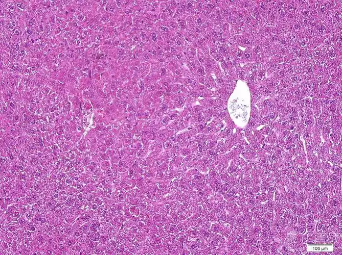 关于小鼠肝脏病理切片的请教