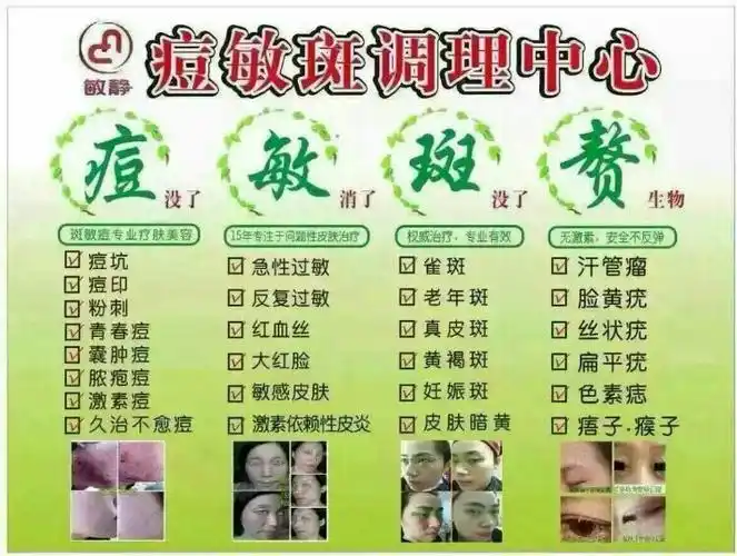 郎溪敏静痘敏斑