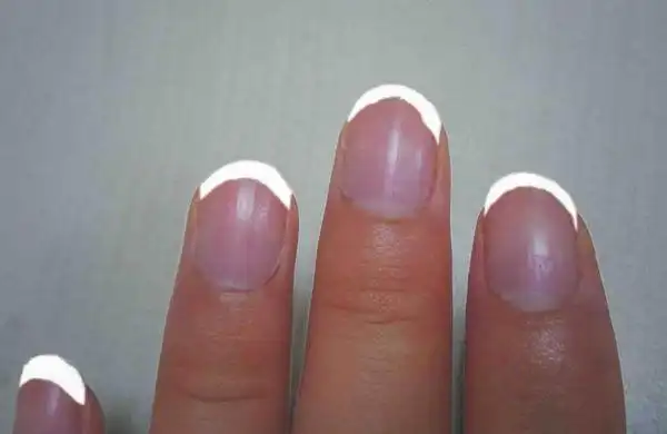 手指甲前端发白怎么办?