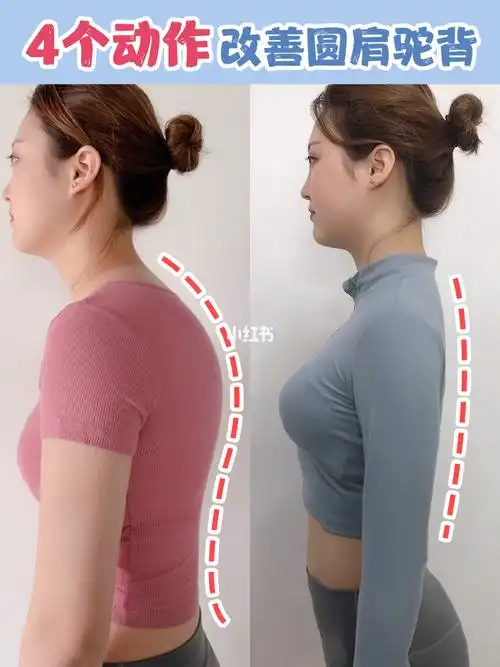 46615个动作改善圆肩驼背7515养成少女背天鹅颈