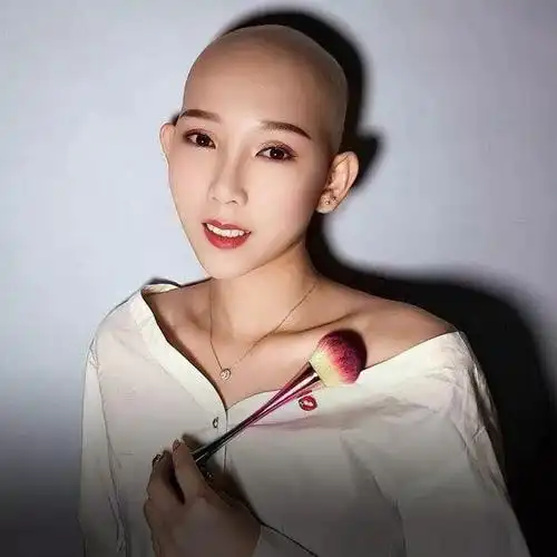 头发掉光形象尽毁哭了几个月后光头美女竟成带货网红