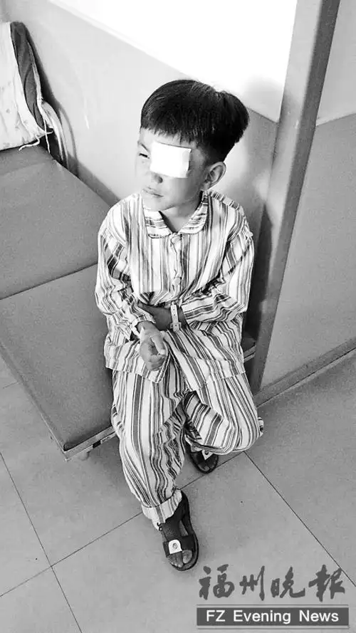 5岁男孩玩剪刀险失明 刀扎入眼中晶状体被扎破