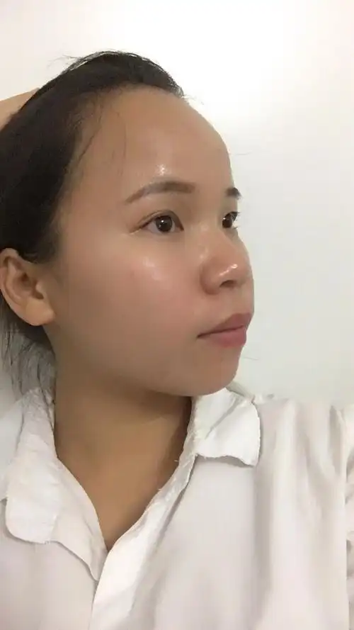 这个是日月角吗?