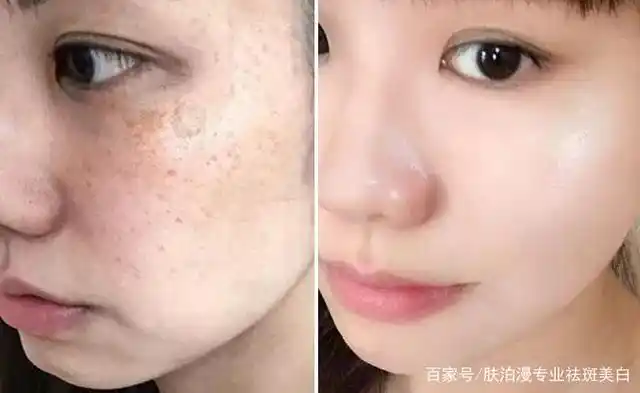 想像她们一样成功淡斑吗?那么日常生活中,应该做到这些