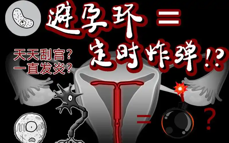 体内定时炸弹上环到底有多可怕避孕环原理到底是什么塞个石头也有用灰