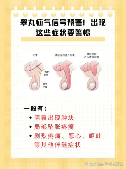 睾丸疝气主要表现为阴囊部位出现可复性肿块,坠胀疼痛等症状,严重时还