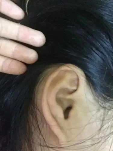 女,22岁,耳垂小,第一张左耳,第二张右耳,哪位懂周易的能给看看相