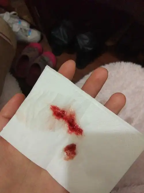 还在咳嗽,吐了几口全是血痰