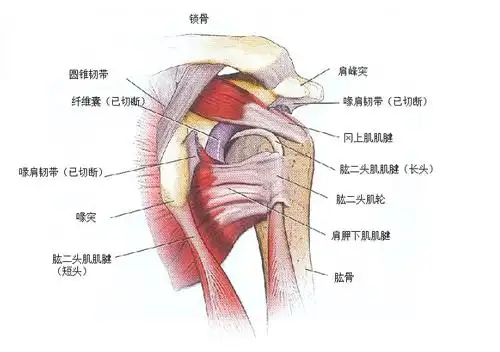 超声引导下肱二头肌肌腱炎注射技术