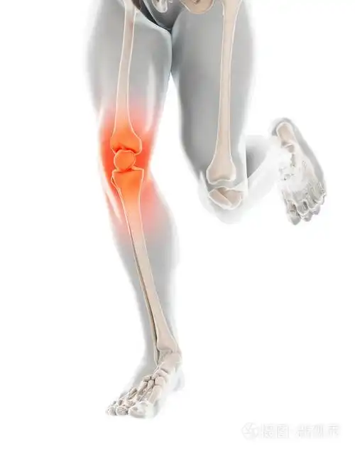 膝关节疼痛骨骼x射线三维插图医学概念