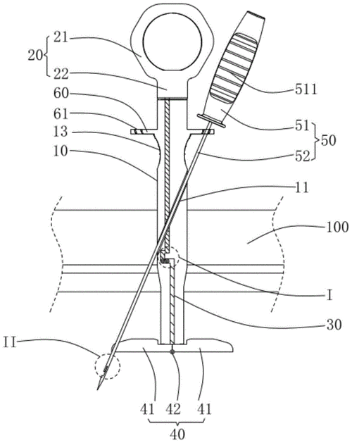 缝合器的制作方法