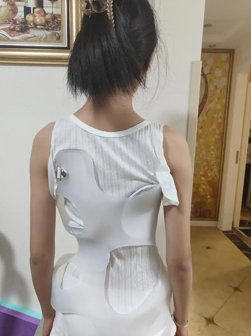 第二个支具了,希望越来越好,加油!#脊柱侧弯