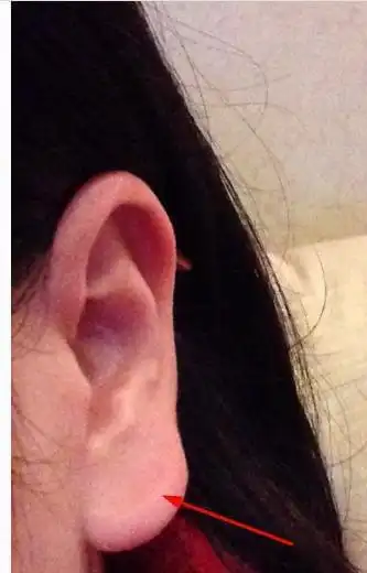 耳垂圆润浑厚垂珠朝口的人,这辈子既有钱又长寿耳垂朝口耳门也就是