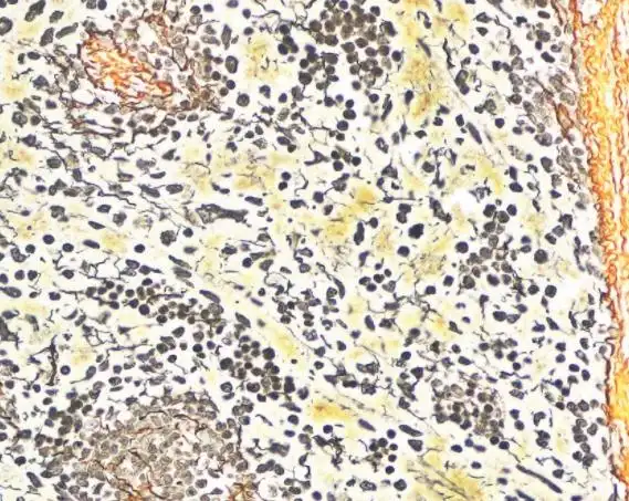 网状纤维染色试剂盒改良gomori银氨法的应用