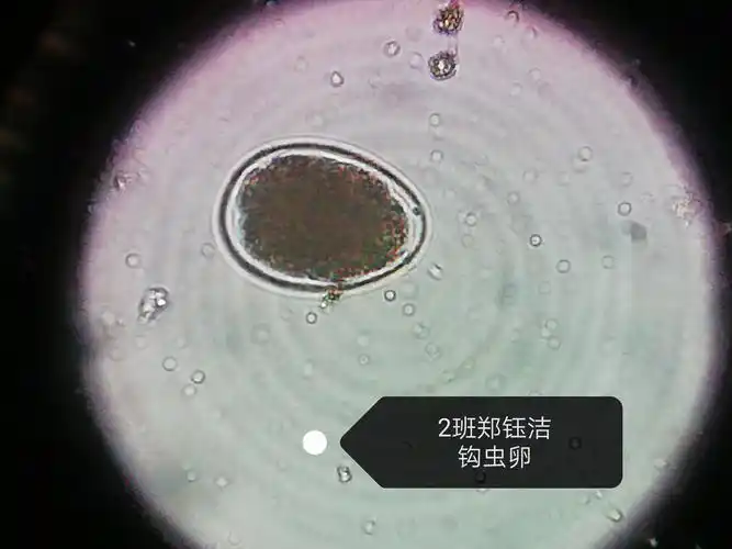 寄生虫——18级检验二班郑钰洁