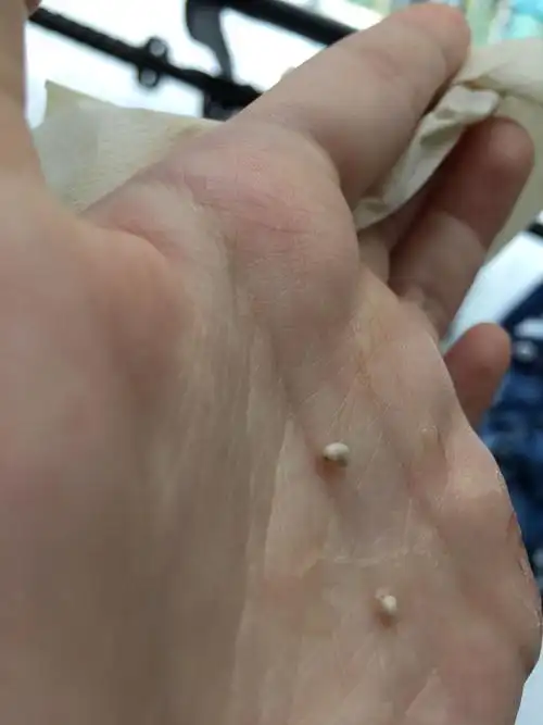 今天红豆粥里的虫子有人知道是什么虫吗