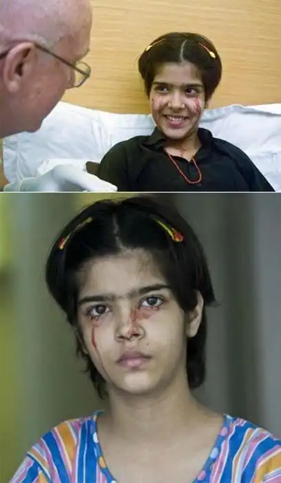 世界上真实存在的变异人图