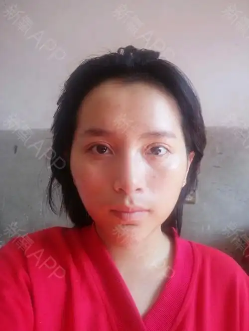 我颧骨宽总是显的脸大想上镜一些能更自信的面对男神