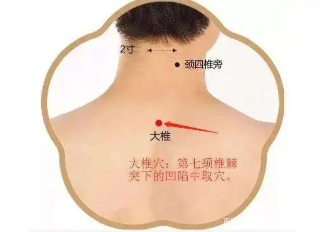 【每日一穴】脖子后有一个重要穴位,是调理颈椎病的奇穴!