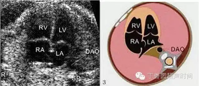 超声微课堂正常胎儿妊娠中期超声检查标准切面