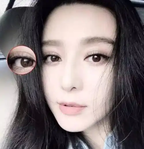 这张堪称隐形双眼皮贴的模范,要不是眼尾处有褶皱