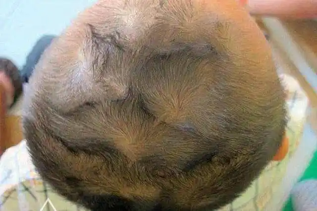 女孩额头有个旋旺父母(女孩前额头有个旋旺父母)