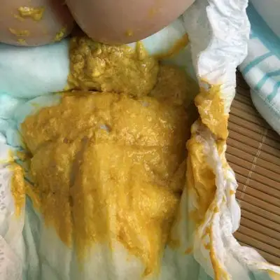 4个月奶粉餵养一天拉2到3次便便都是金黄色的那样正常吗