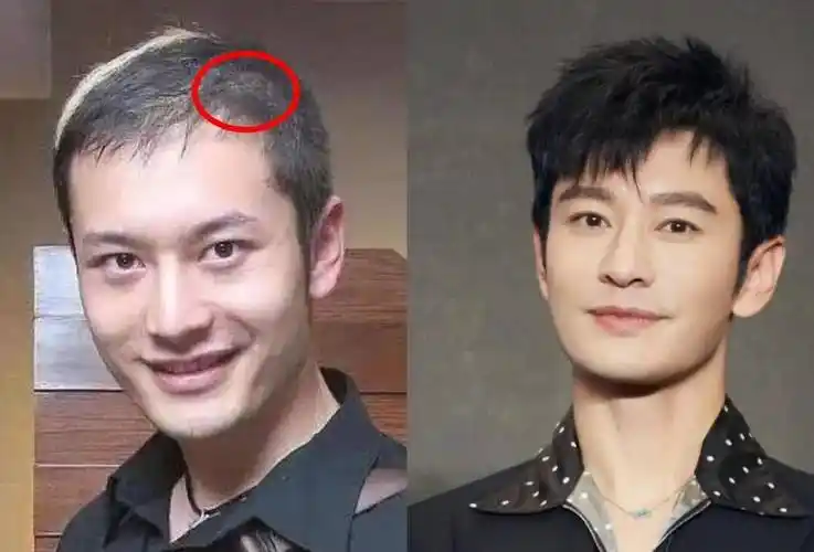 别看《中餐厅》里的黄晓明有着一头乌黑亮丽的头发,但看他以前的照片