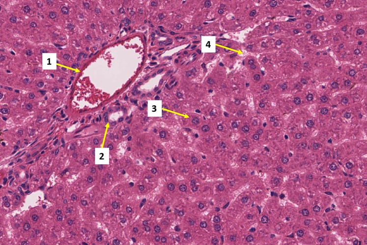 1为中央静脉 b,标记2为小叶间胆管 c,标记3为肝细胞 d,标记4为肝血窦