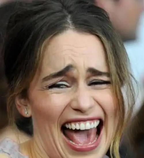 有种毁容叫龙妈的笑一笑就成囧囧脸网友求你别再笑