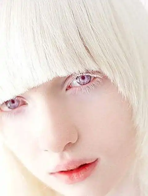 实拍乌克兰最美白化病女孩,她是上帝不小心遗落在世间的天使