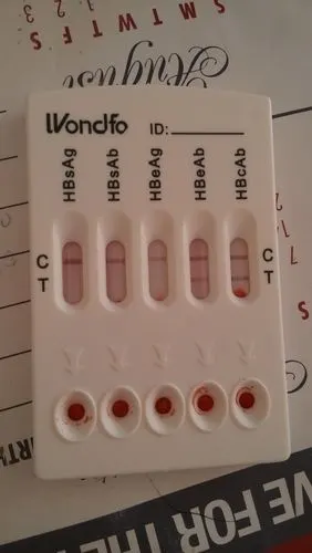 肝功检查结果以及乙肝五项检查结果咨询