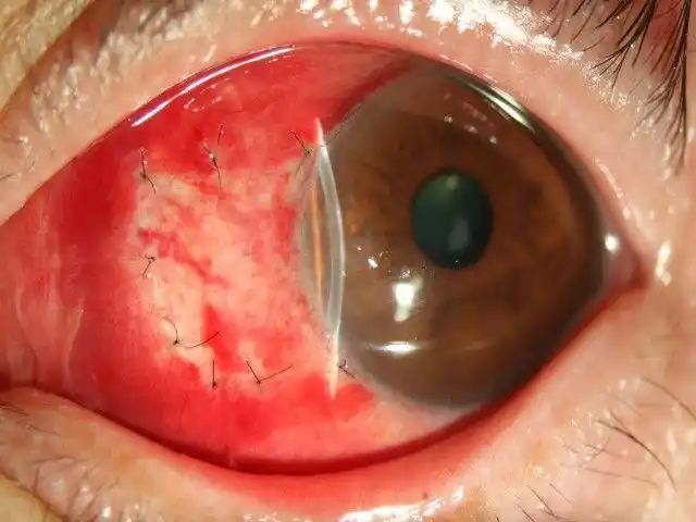 点击查看源网页